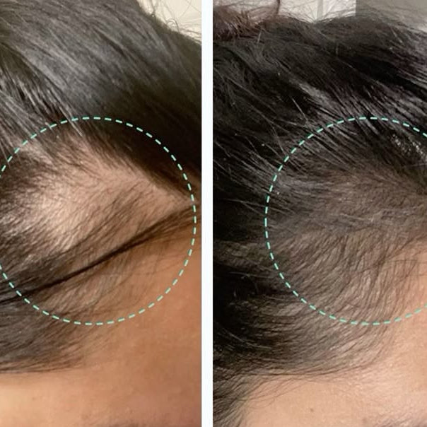 Hair Food — Herbal Hair Elixir Oil
