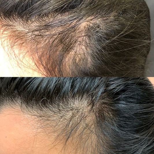 Hair Food — Herbal Hair Elixir Oil